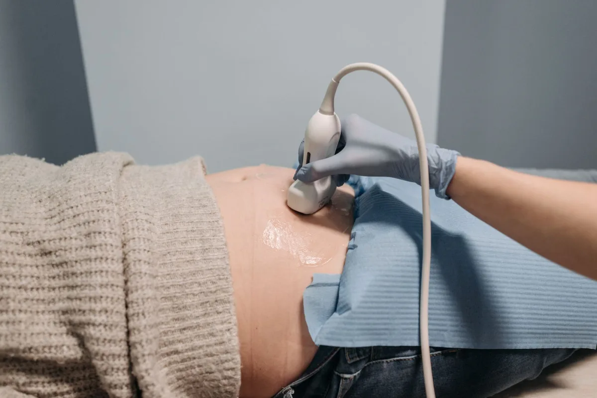 Ultralydsprobe med gel mod en gravid mave under en tidlig scanning