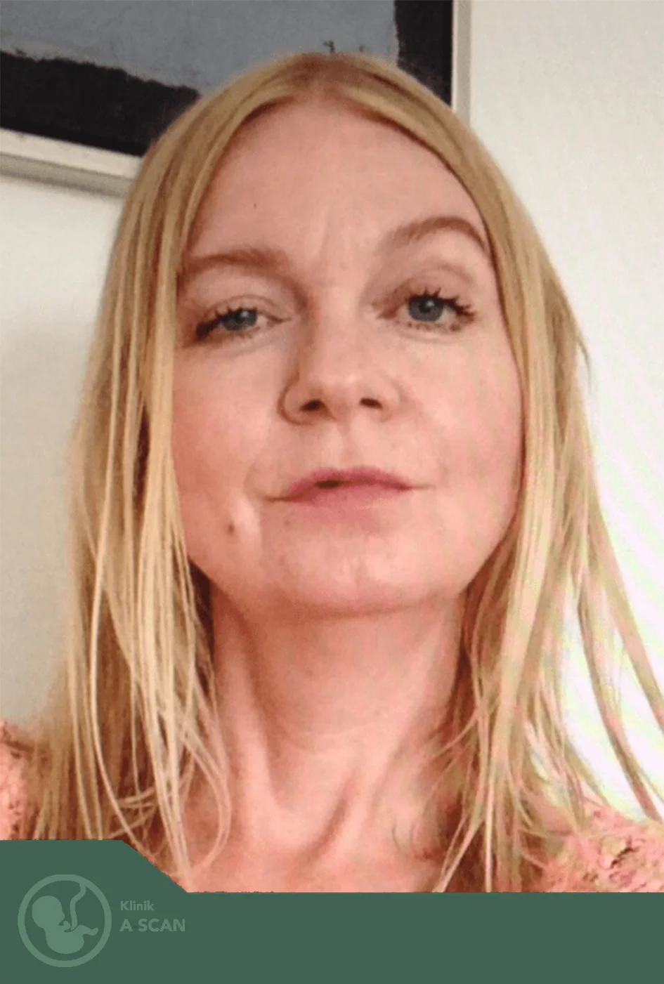 Susanne V. Nielsen — Sygeplejerske & Sonograf hos Klinik A-SCAN