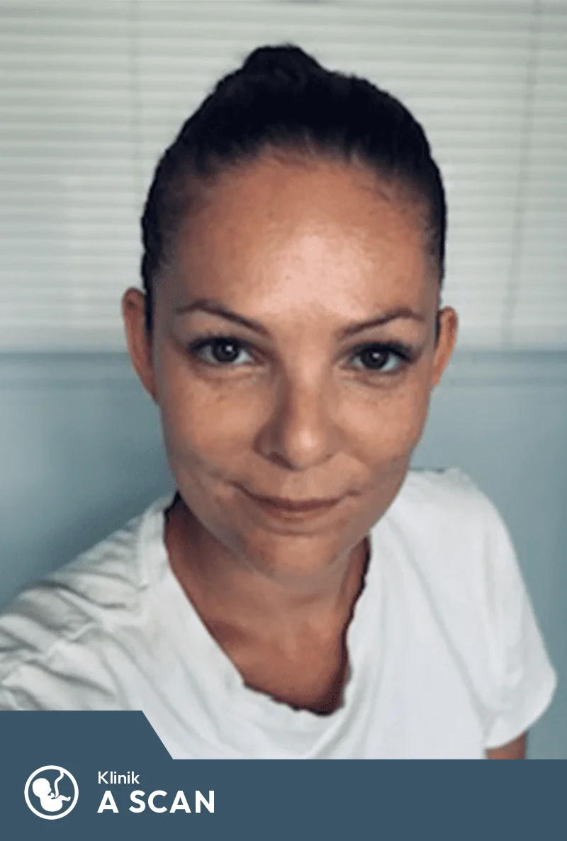 Vibeke Larsen — Sygeplejerske & Sonograf hos Klinik A-SCAN