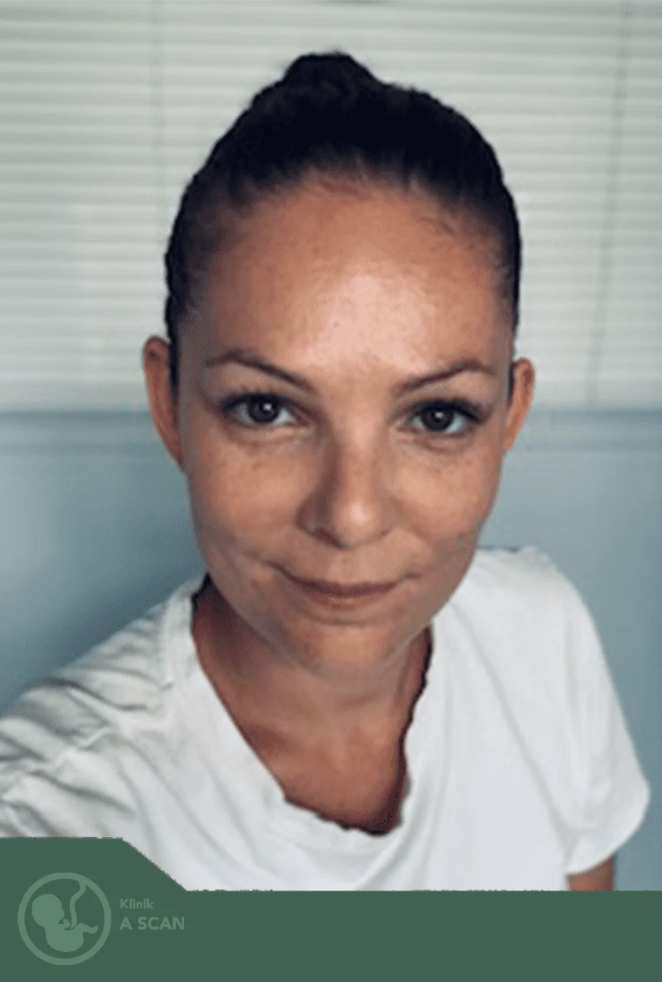 Vibeke Larsen — Sygeplejerske & Sonograf hos Klinik A-SCAN