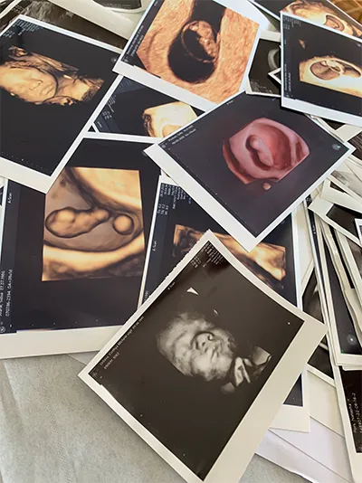 Fødselsforberedelse hos Klinik A-SCAN i Hillerød