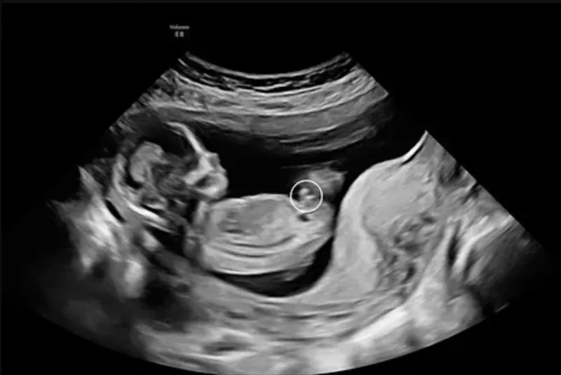 Kønsscanning hos Klinik A-SCAN