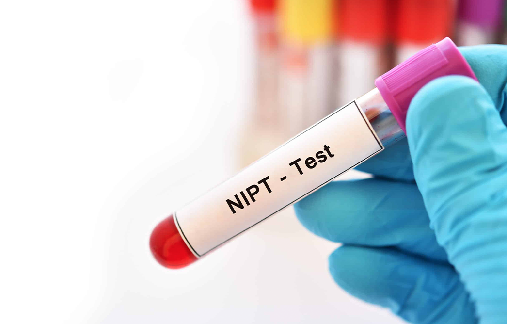 NIPT Panorama Test hos Klinik A-SCAN