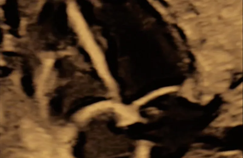 Sen Gennemscanning hos Klinik A-SCAN