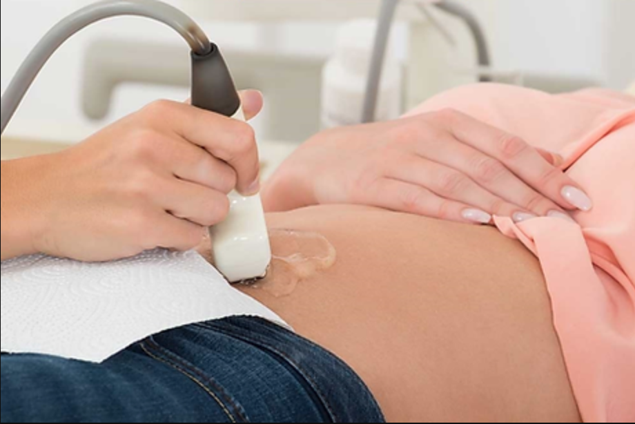Graviditetsscanning, kønsscanning, nakkefoldsscanning, tidlig scanning, 3d scanning baby, 3d scanning gravid, ultralydsscanning,